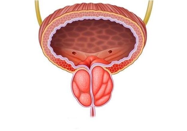 Prostataentzündung bei Männern