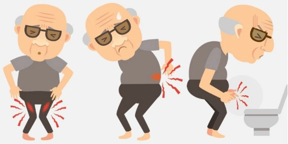 Prostatitis Symptome