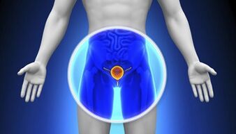 Behandlung von Arzneimittelprostatitis
