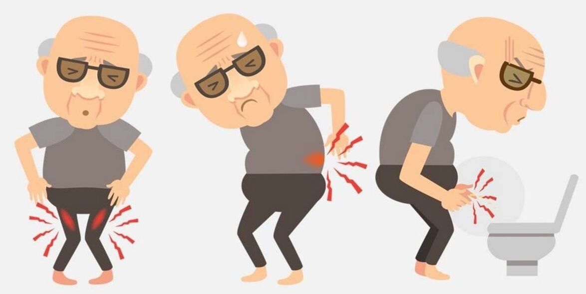 Prostatitis-Symptome