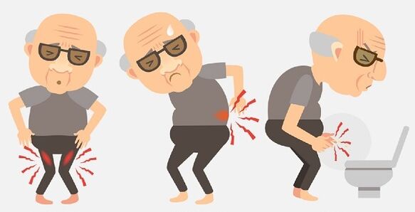 Symptome einer Prostatitis und ihre Behandlung mit Medikamenten.